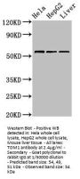 TOM1 Antibody