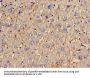 TOM1 Antibody