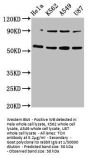 TOX Antibody