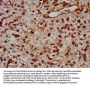 TOX Antibody