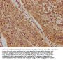 TP73 Antibody