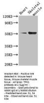 TPH1 Antibody