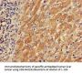 TPM3 Antibody