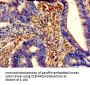 TPM3 Antibody