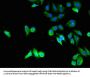TPM3 Antibody