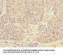TPM4 Antibody