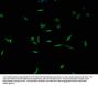 TPP2 Antibody