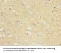 TPPP Antibody