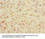 TPPP Antibody