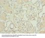 TPPP2 Antibody