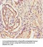 TPST2 Antibody