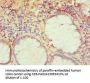 TRAF3IP2 Antibody