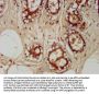 TRAPPC6A Antibody