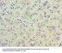 TRBC1 Antibody