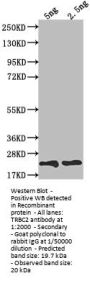 TRBC2 Antibody