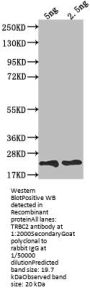 TRBC2 Antibody