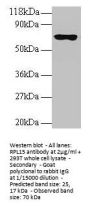 RPL15 Antibody