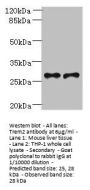 Trem2 Antibody