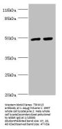 TRIM13 Antibody