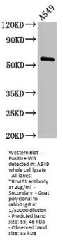 TRIM21 Antibody