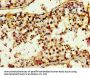 TRIM3 Antibody