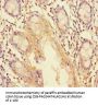 TRIM37 Antibody