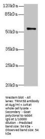 TRIM38 Antibody