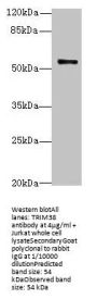 TRIM38 Antibody
