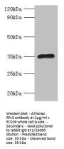 RPL5 Antibody