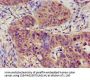TRPC1 Antibody