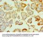 TRPM2 Antibody