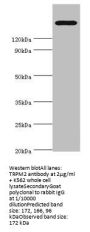 TRPM2 Antibody