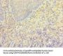 TRPM2 Antibody