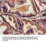 TSLP Antibody