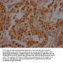 POLR2A Antibody