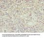 Ttr Antibody