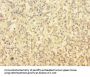 TUBAL3 Antibody