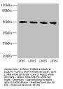 TUBB2A Antibody