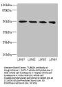 TUBB2A Antibody