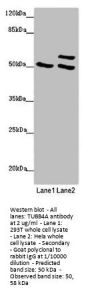 TUBB4A Antibody