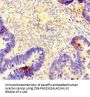 TUBB4A Antibody