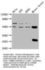 TUBB4A Antibody