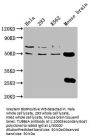 TUBB4A Antibody