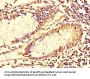 TUBG1 Antibody