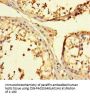 TULP3 Antibody