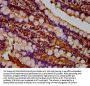 TUSC3 Antibody