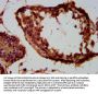 TUSC3 Antibody