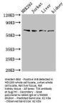 TXK Antibody