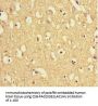 TXNDC9 Antibody