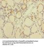 TXNL1 Antibody